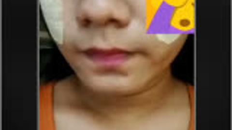 တောသူအထန်လေး — XBurma Myanmar video preview