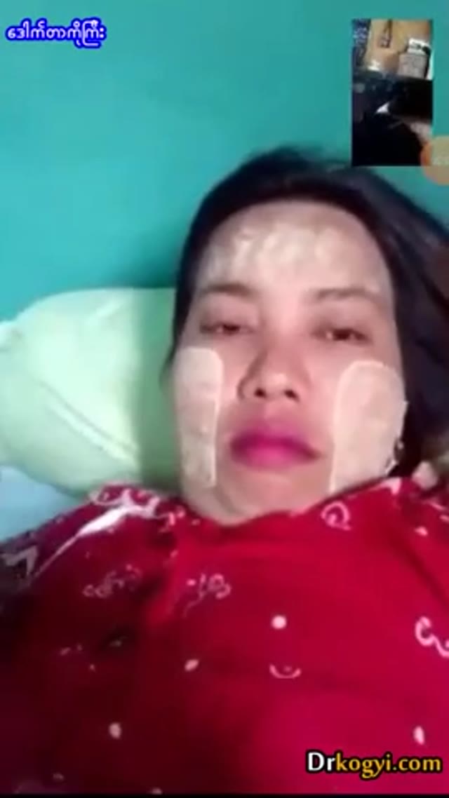 သနပ်ခါးပါးကွက်ကြားနဲ့အကိတ်မမ — XBurma Myanmar video preview